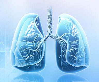 RHP-lungs-2